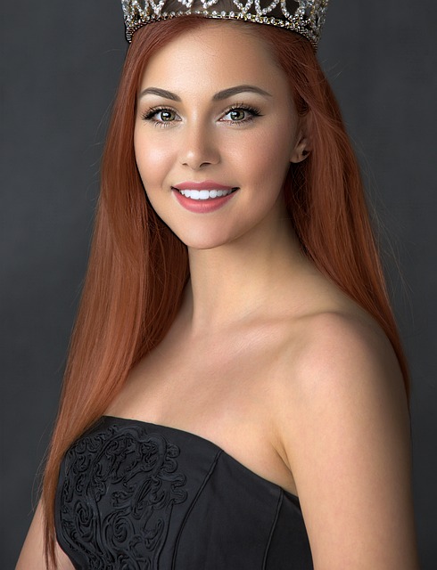 拜仁在处理 拜仁在处理